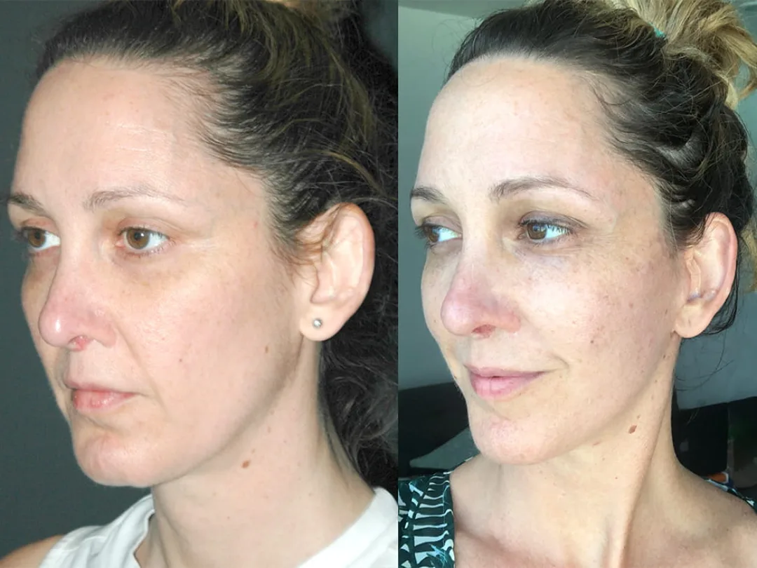 Before and after — Dr. Sean Malone