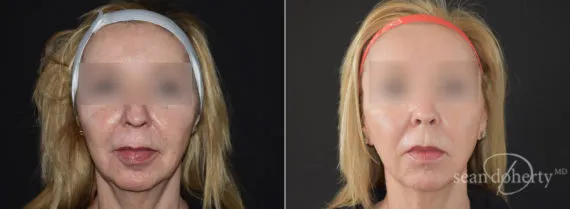 Before and after — Dr. Sean Doherty