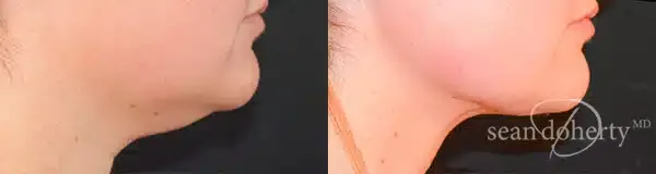 Before and after — Dr. Sean Doherty
