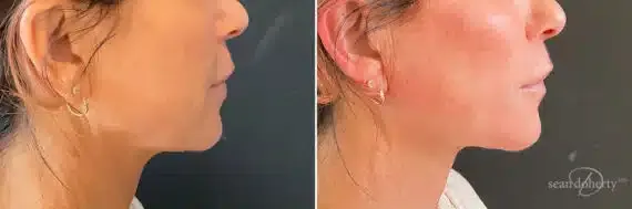 Before and after — Dr. Sean Doherty