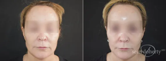 Before and after — Dr. Sean Doherty