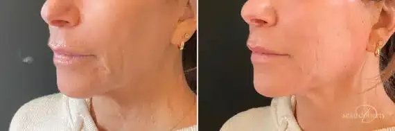 Before and after — Dr. Sean Doherty