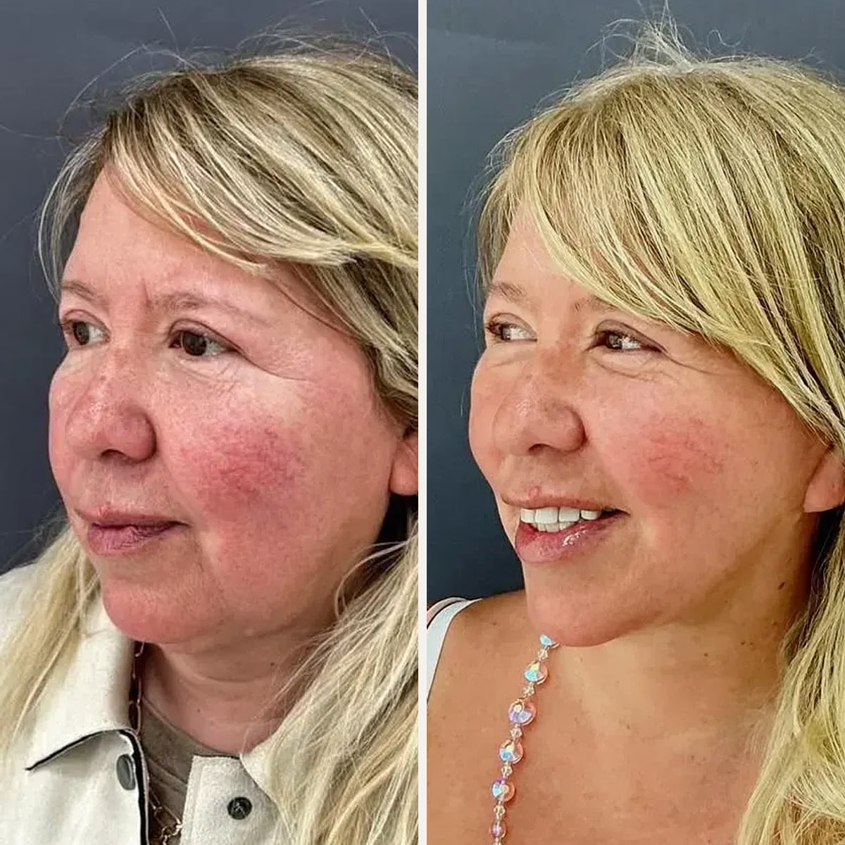 Before and after: Dr. Sebastián Cosentino