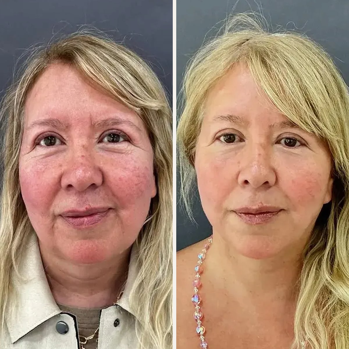 Before and after: Dr. Sebastián Cosentino