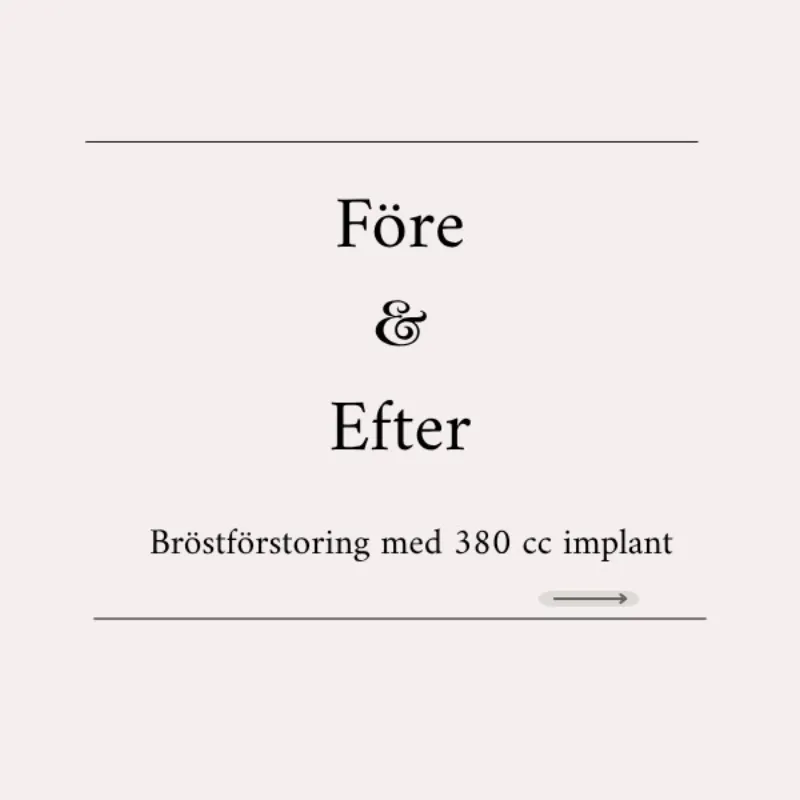 Before and after — Dr. Selçuk Kuyubaşı