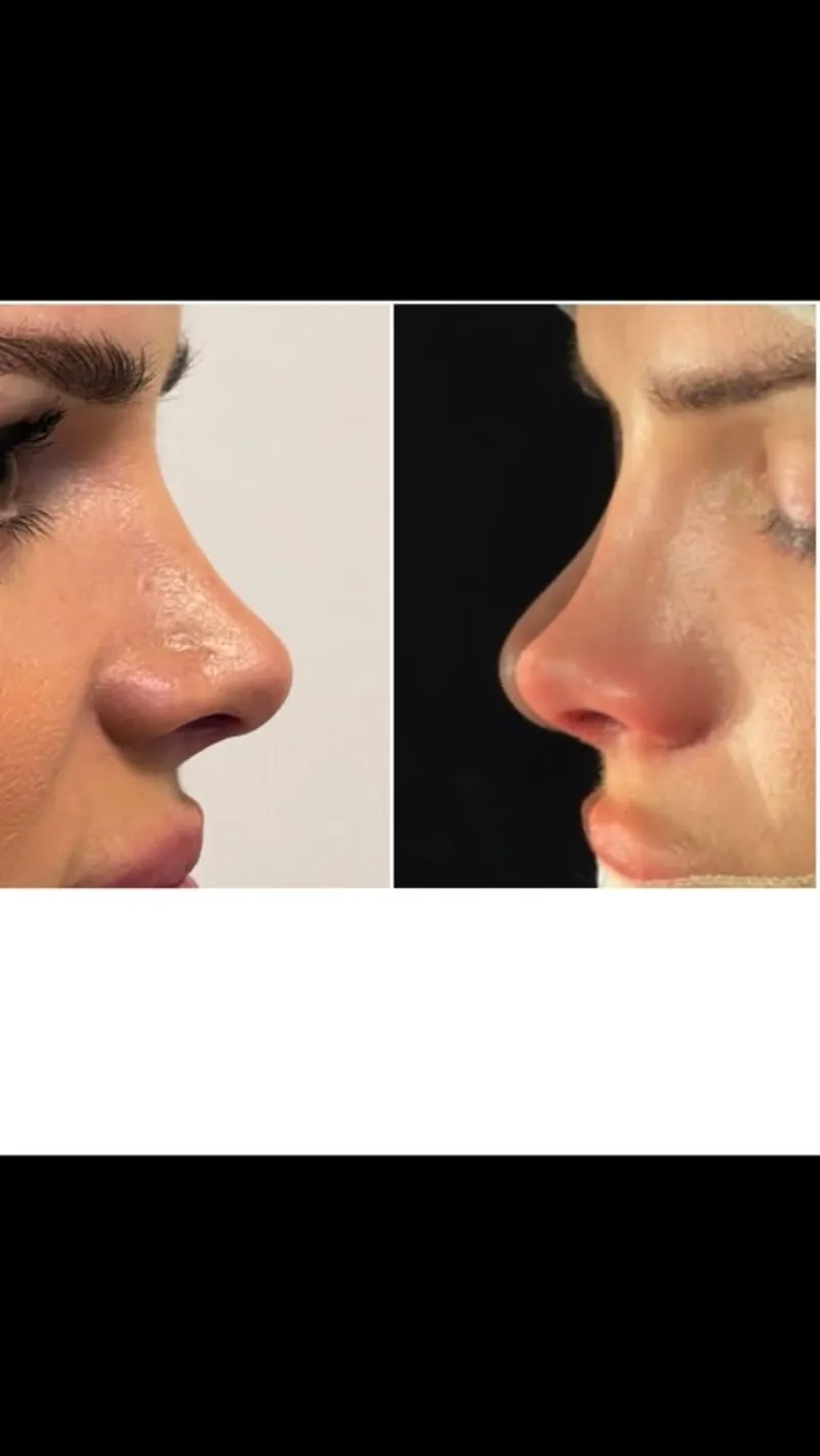 Before and after — Dr. Selçuk Yazan