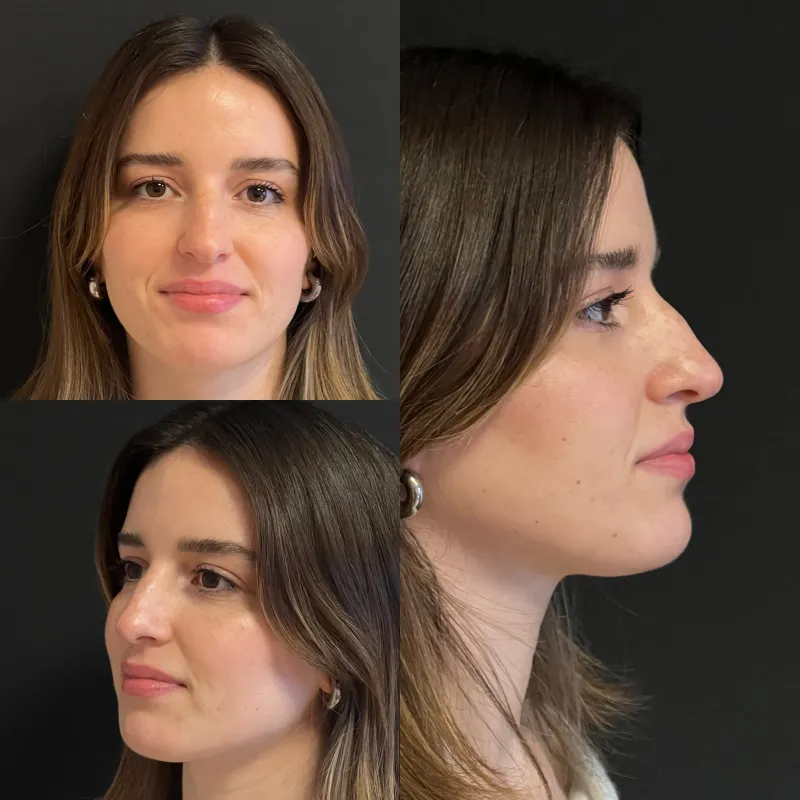 Before and after — Dr. Selim Kul