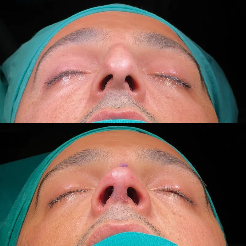 Before and after — Dr. Selim Kul