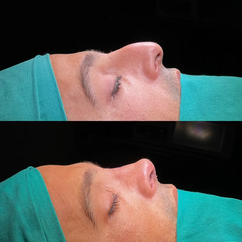 Before and after — Dr. Selim Kul