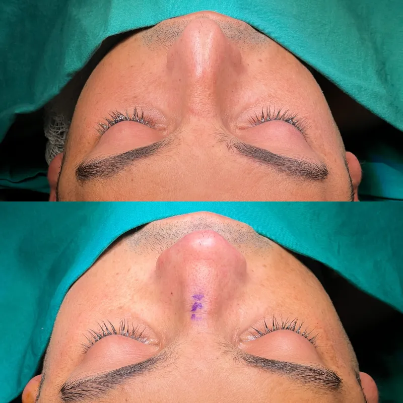 Before and after — Dr. Selim Kul