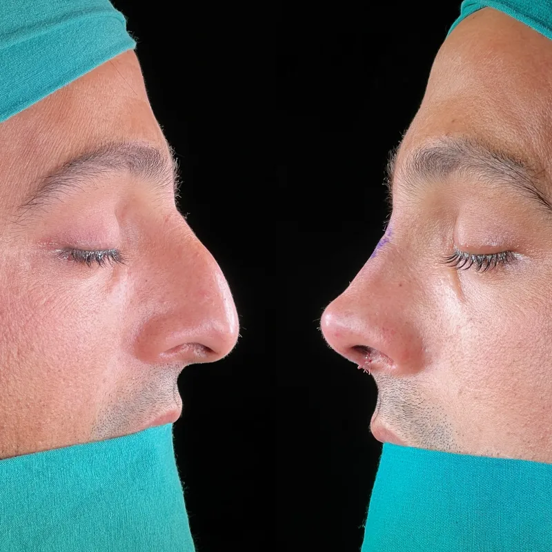 Before and after — Dr. Selim Kul