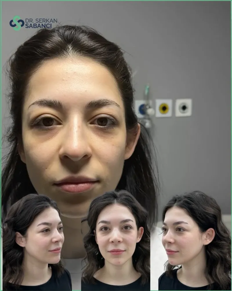 Before and after: Dr. Serkan Sabancıoğullarından
