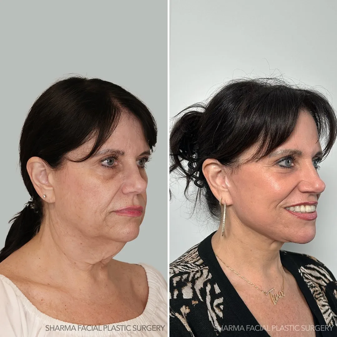 Before and after — Dr. Giriraj Sharma
