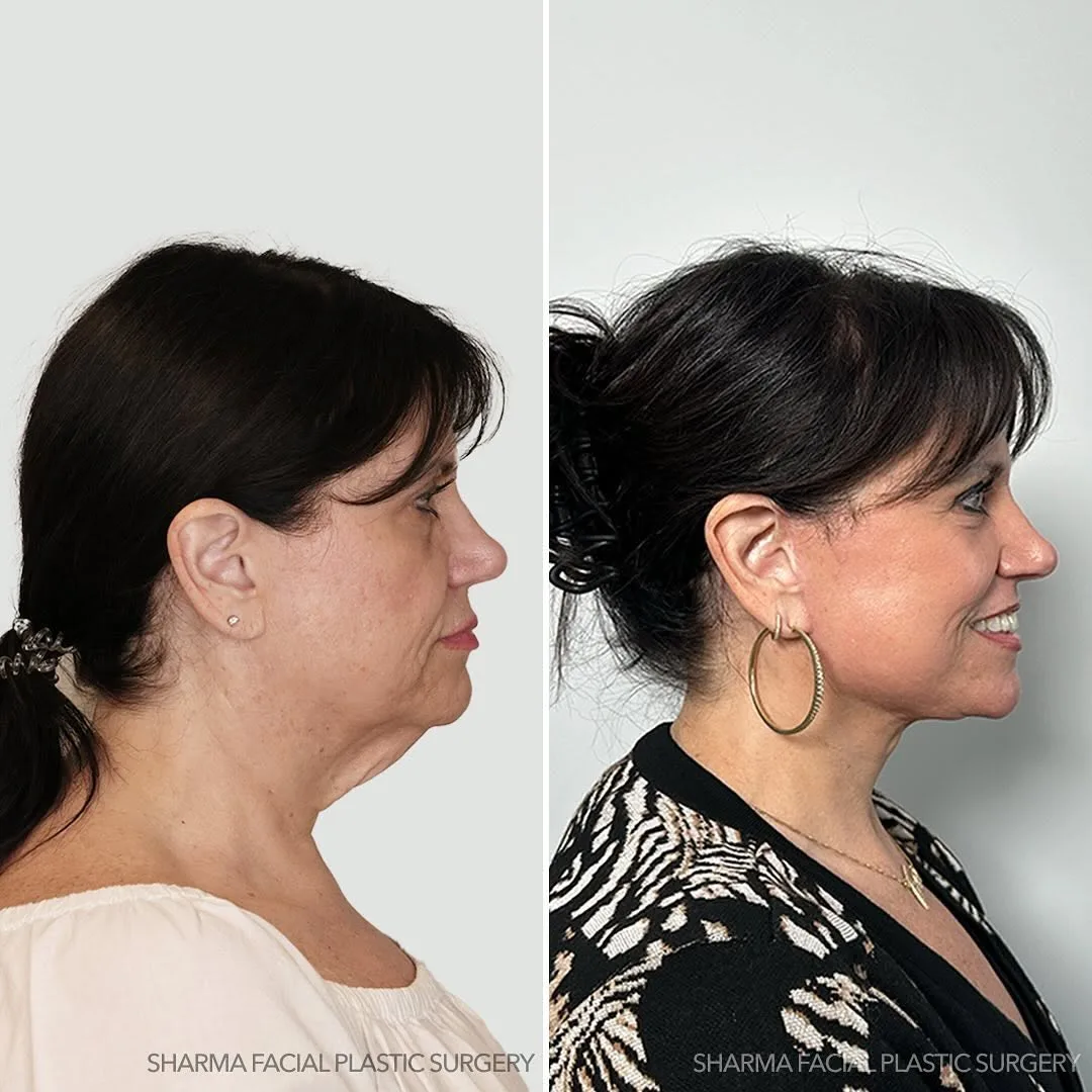 Before and after — Dr. Giriraj Sharma