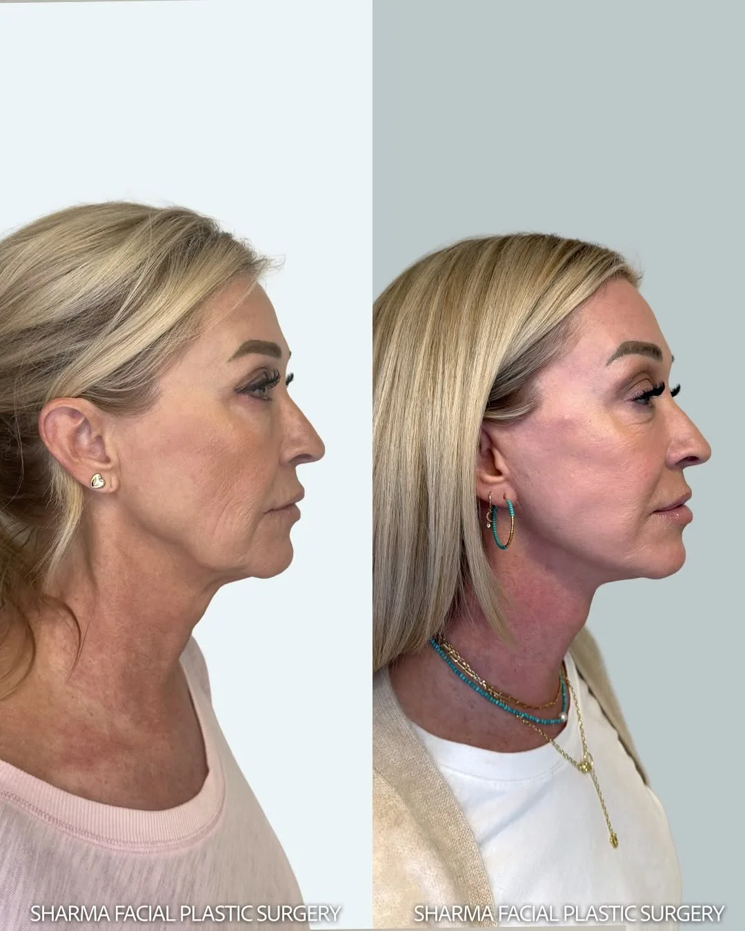 Before and after — Dr. Giriraj Sharma