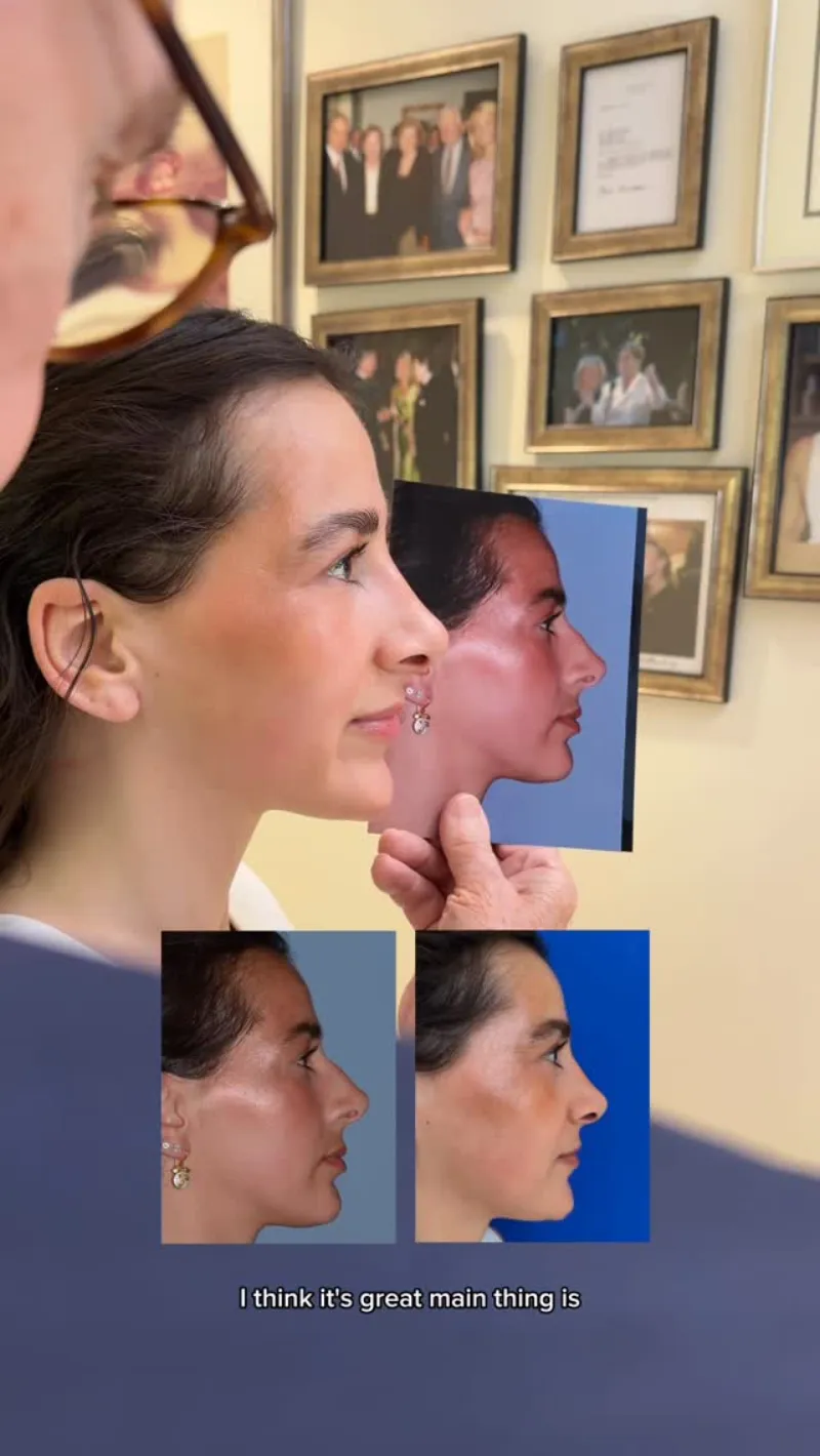 Before and after — Dr. Sherrell Aston