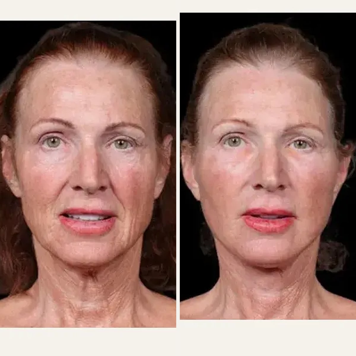 Before and after: Dr. Shim Ching