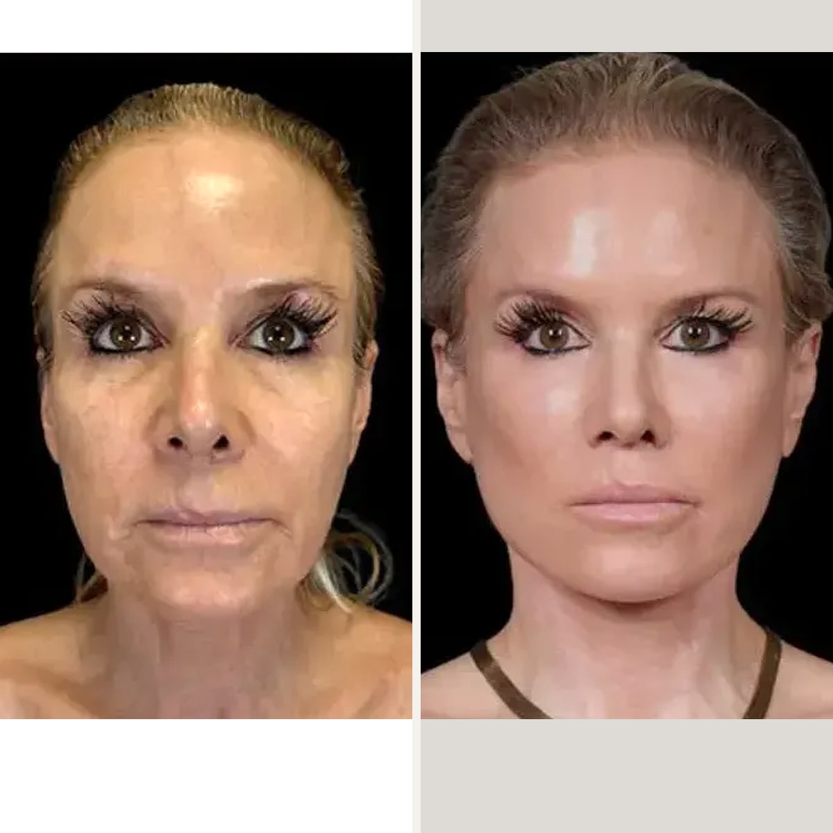Before and after: Dr. Shim Ching