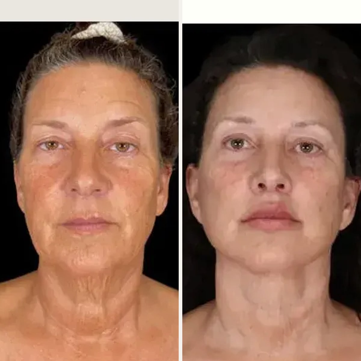 Before and after: Dr. Shim Ching