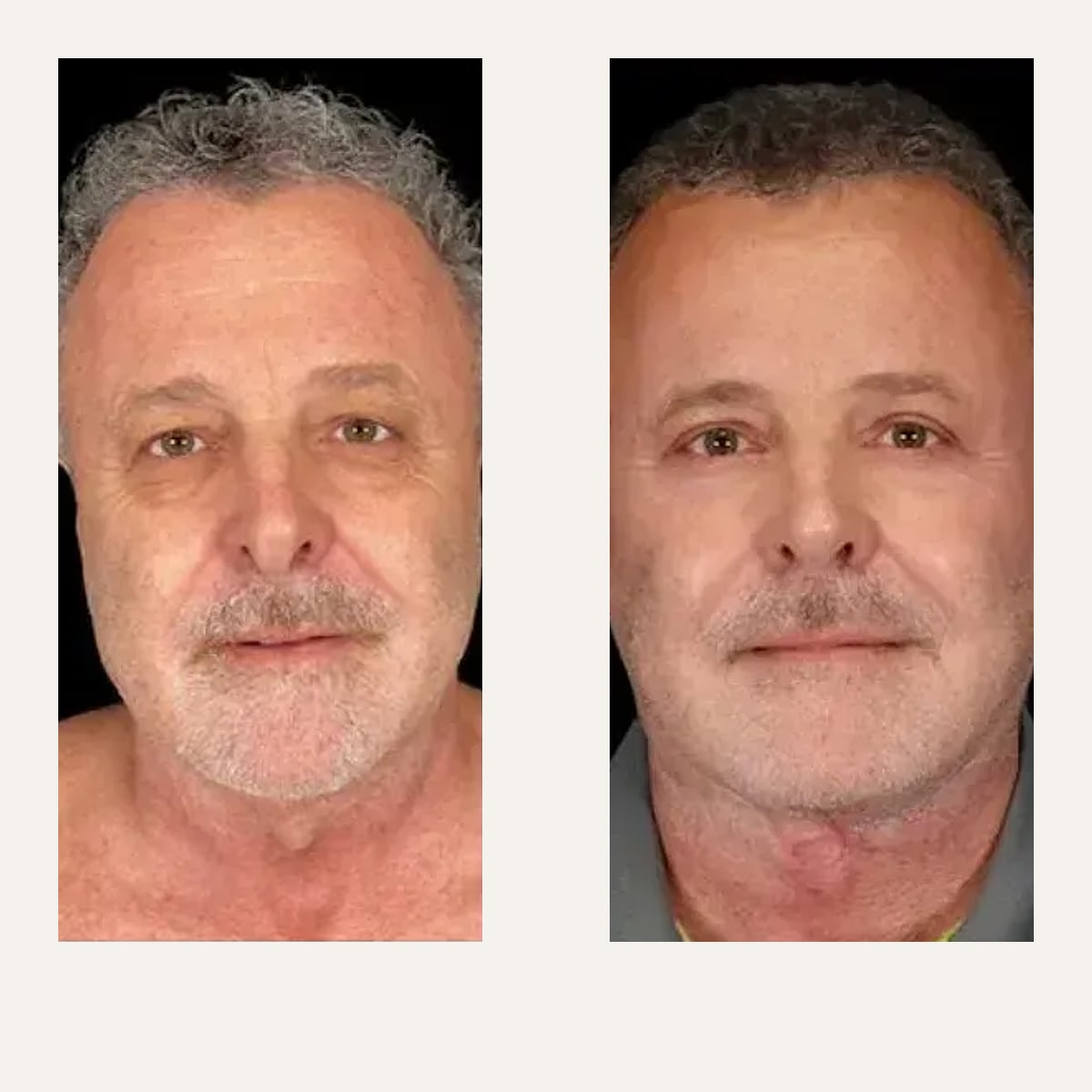Before and after: Dr. Shim Ching