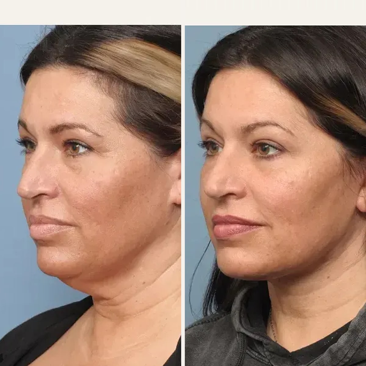 Before and after: Dr. Shirley Hu