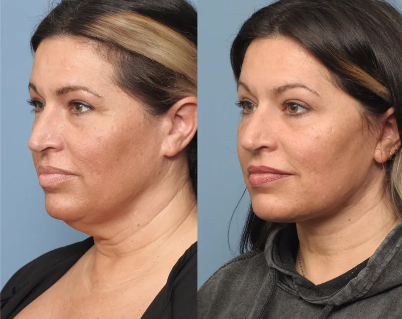 Before and after — Dr. Shirley Hu