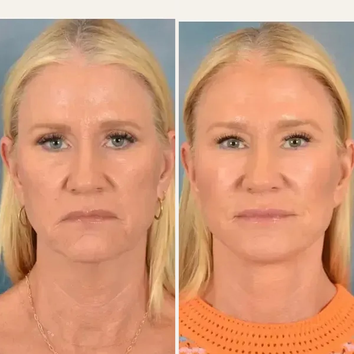 Before and after: Dr. Sidney Starkman