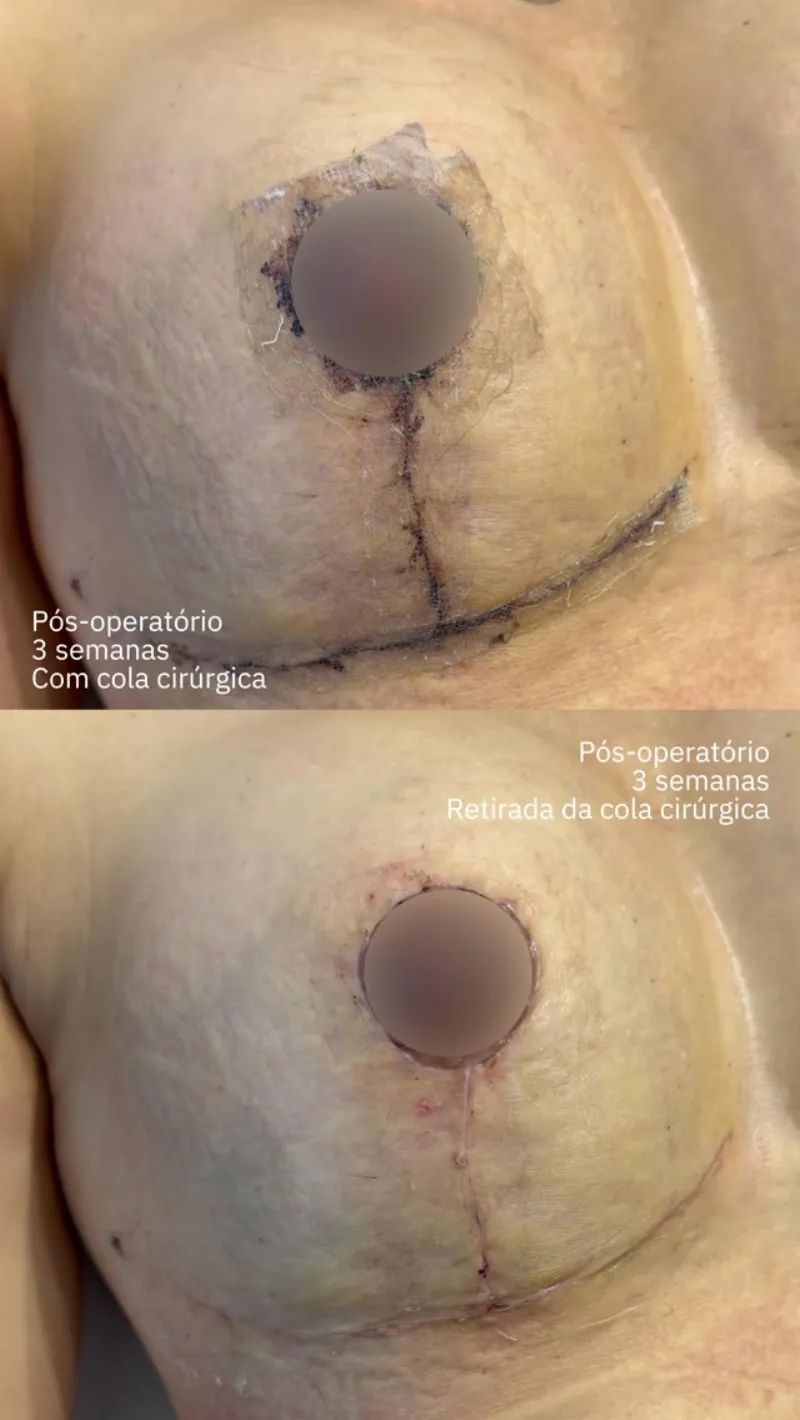Before and after — Dr. Simao Sereno