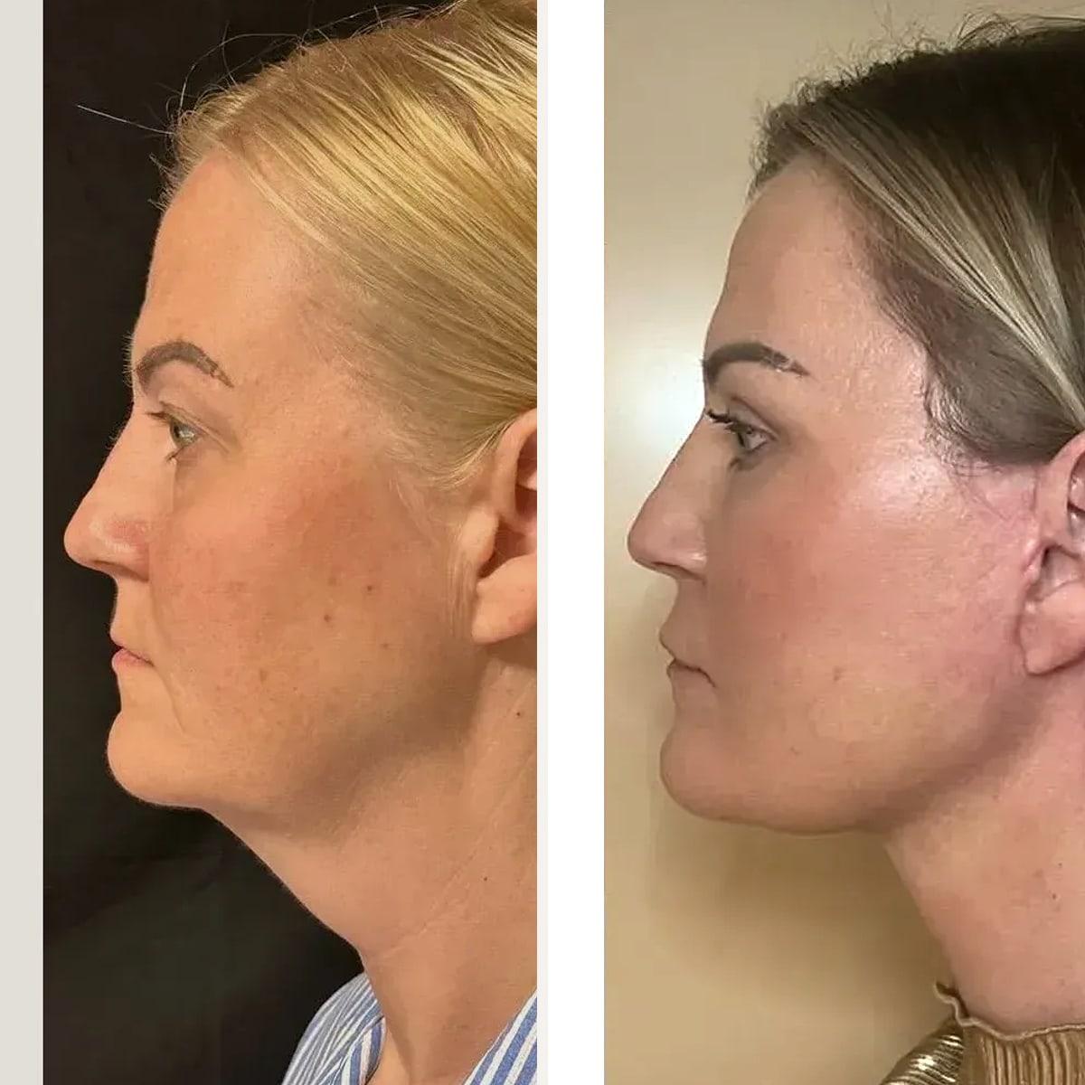 Before and after: Dr. Soner Karaali