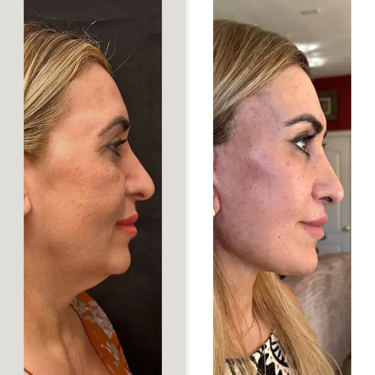 Before and after: Dr. Soner Karaali