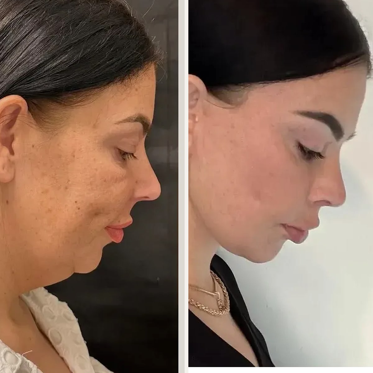 Before and after: Dr. Soner Karaali