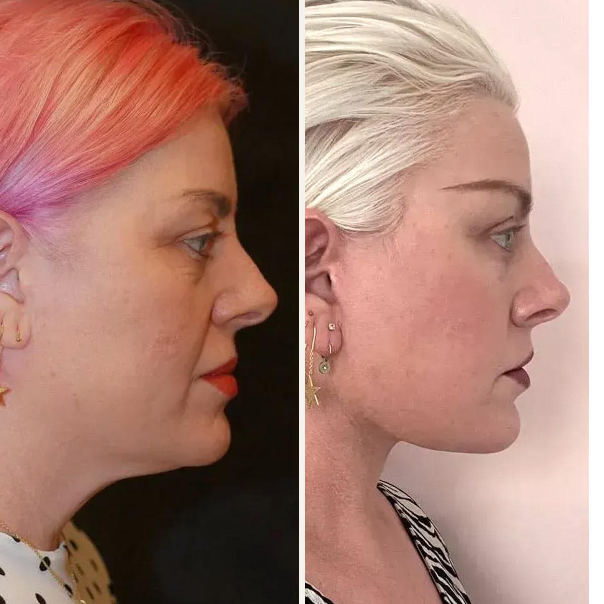Before and after: Dr. Soner Karaali