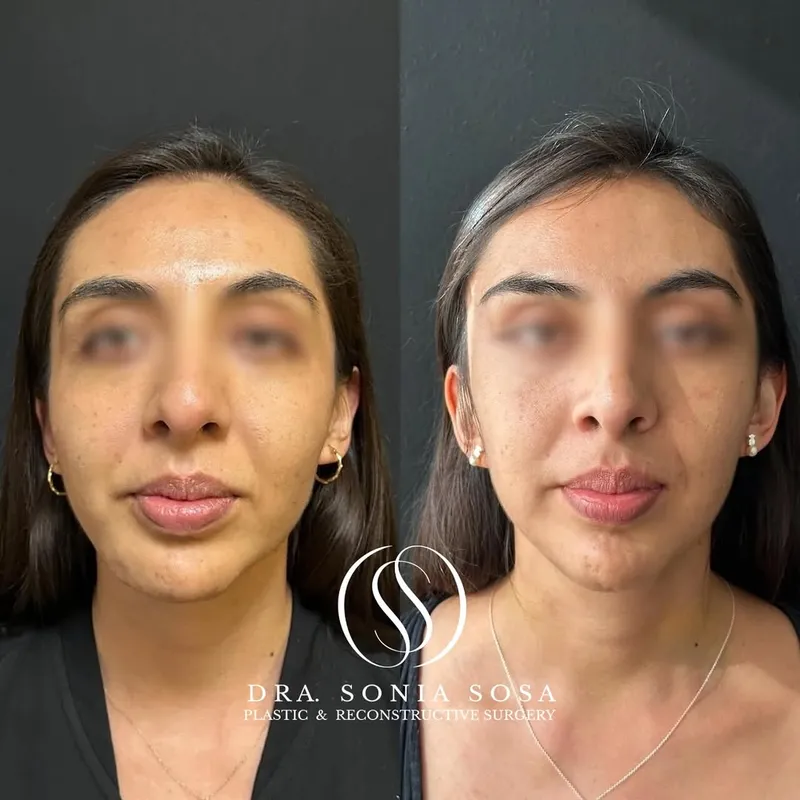 Before and after — Dr. Sonia Sosa