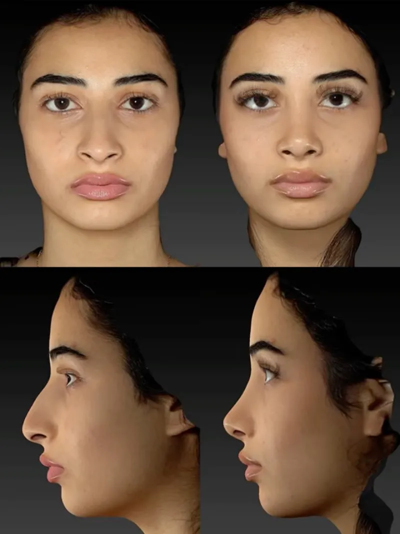 Before and after — Dr. Martin Stepanyan