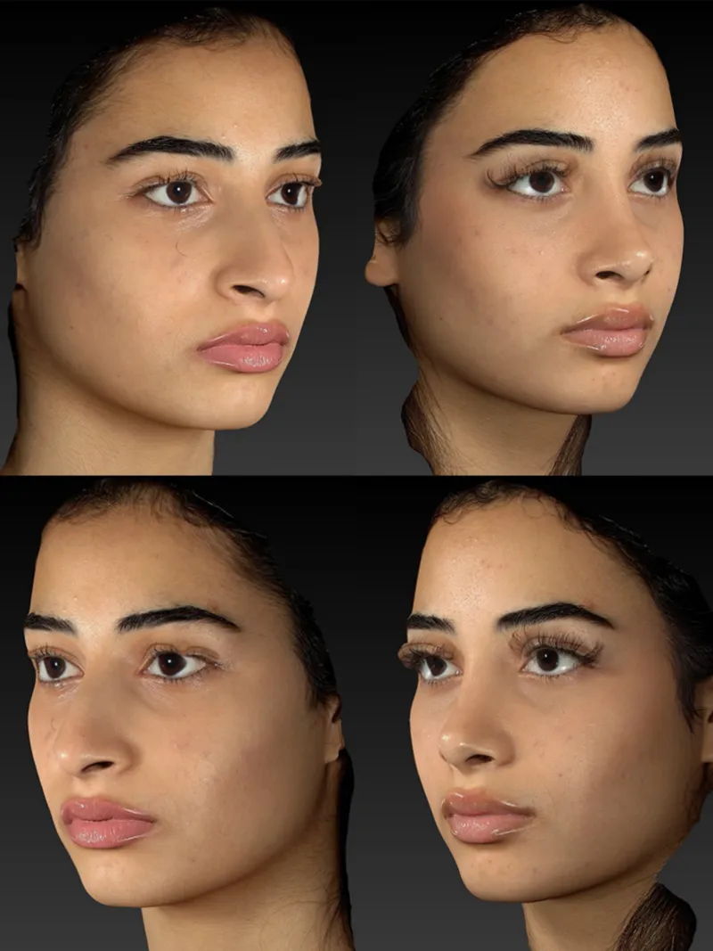 Before and after — Dr. Martin Stepanyan