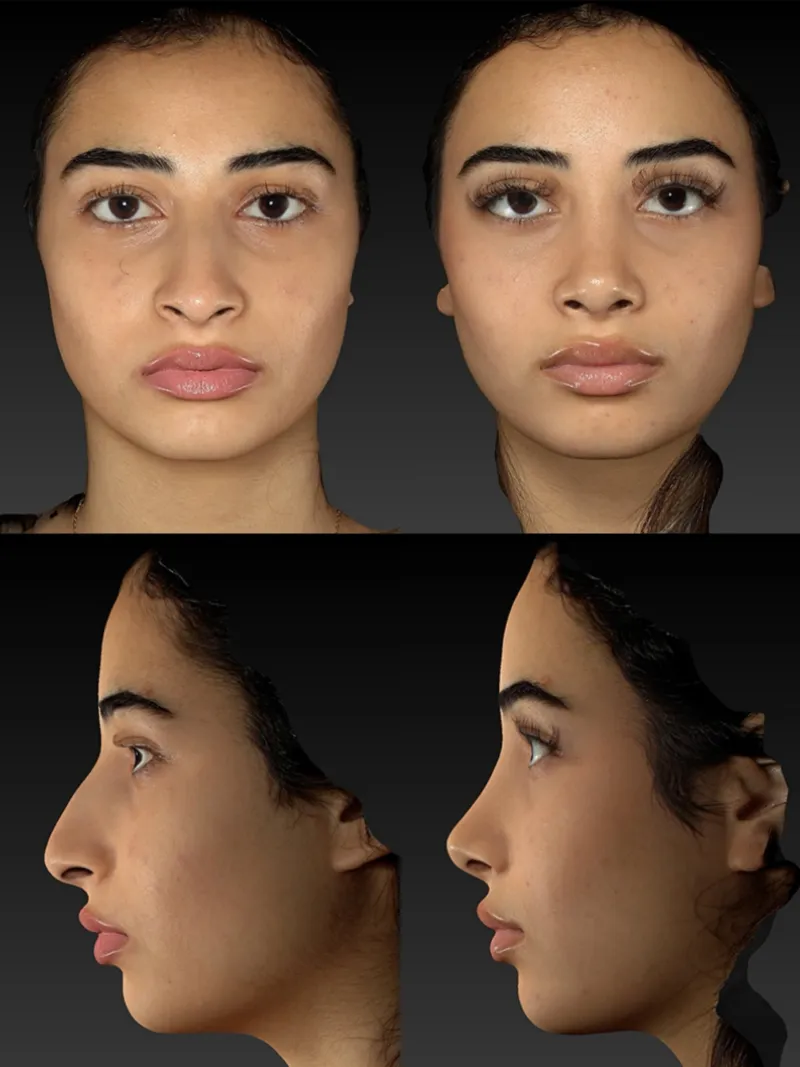 Before and after — Dr. Martin Stepanyan