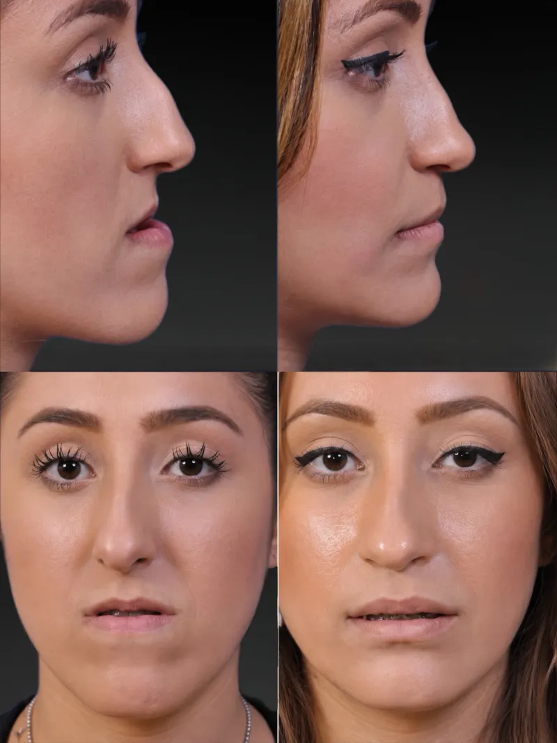 Before and after — Dr. Martin Stepanyan