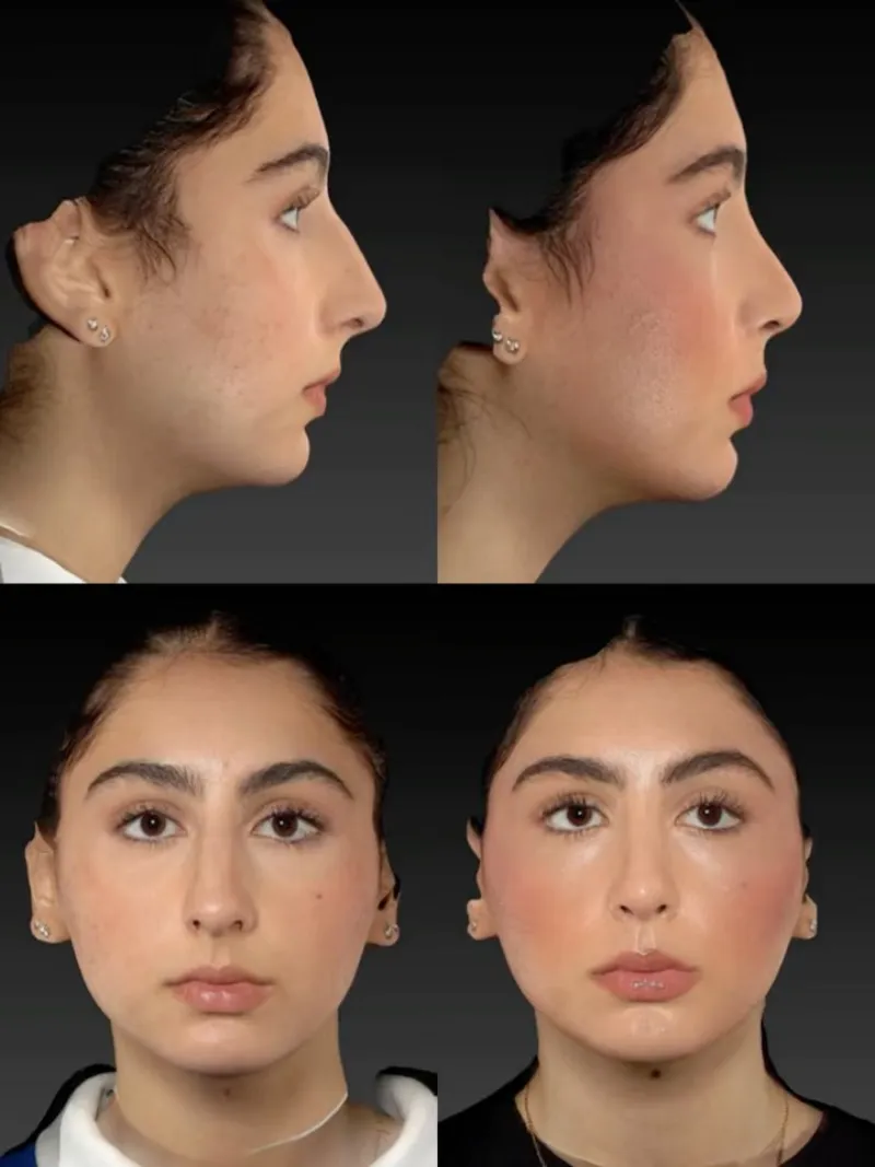 Before and after — Dr. Martin Stepanyan