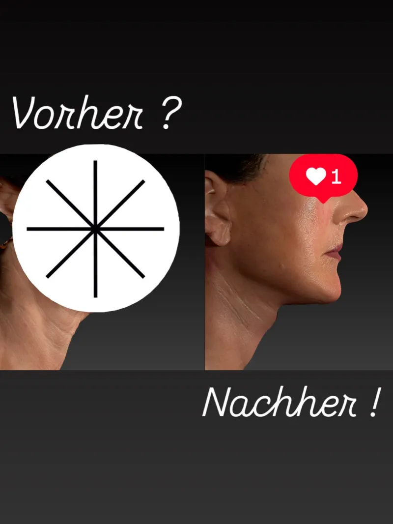 Before and after: Dr. Stephan Hager