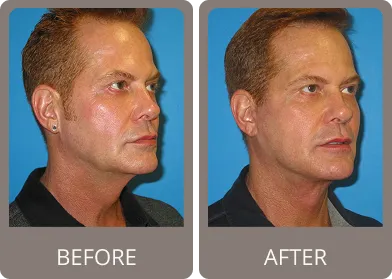 Before and after — Dr. Stephen Prendiville