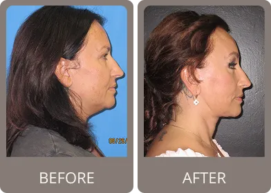 Before and after — Dr. Stephen Prendiville