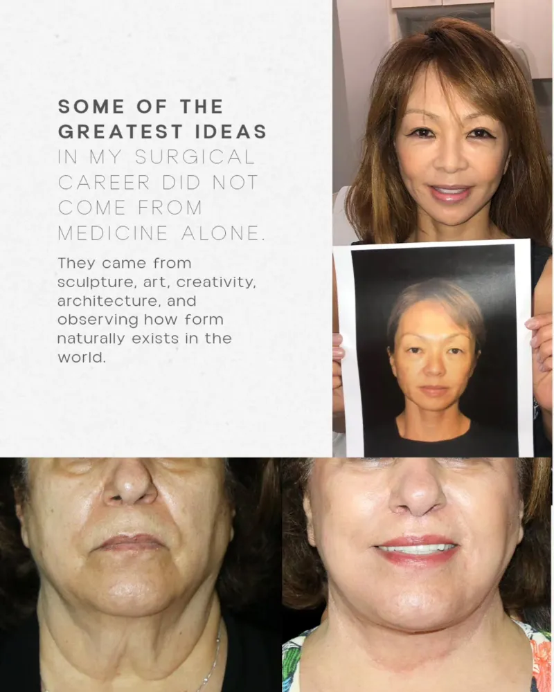 Before and after — Dr. Steven Cohen