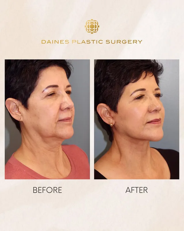 Before and after — Dr. Steven Daines