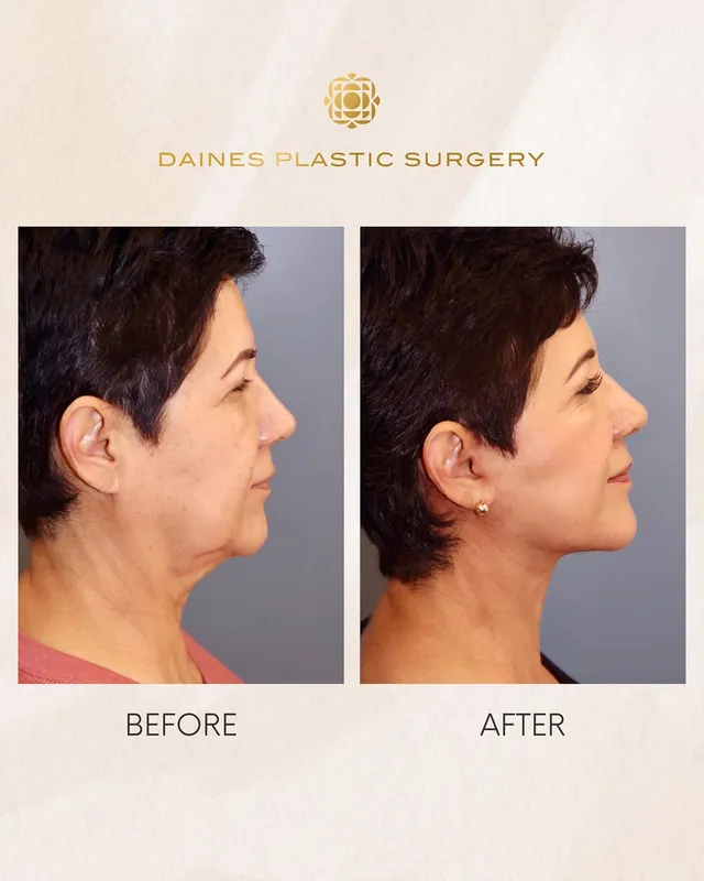 Before and after — Dr. Steven Daines