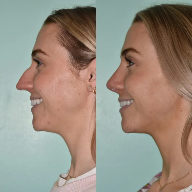 Before and after — Dr. Steven Davis