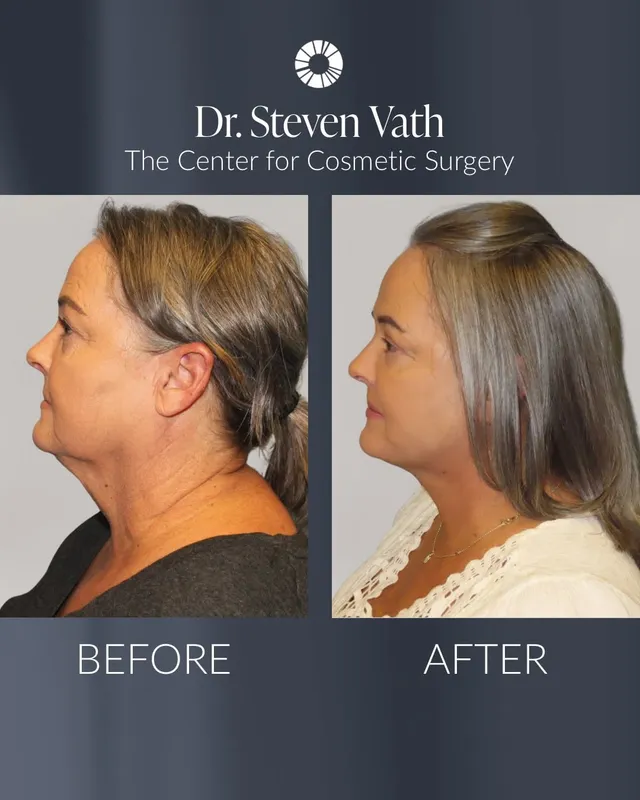 Before and after — Dr. Steven Vath