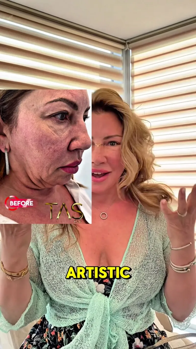 Before and after: Dr. Süleyman Taş