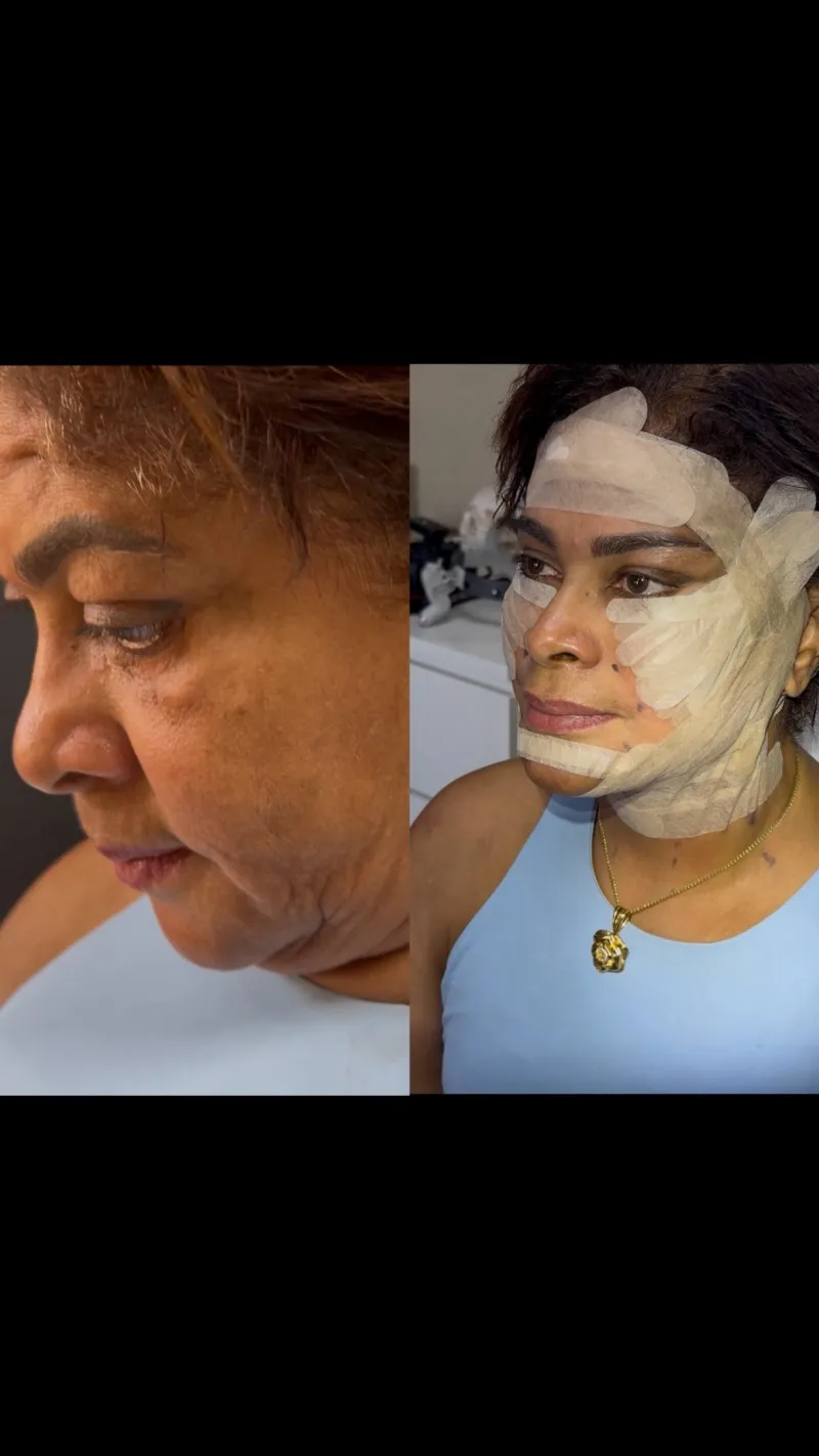 Before and after: Dr. Süleyman Taş