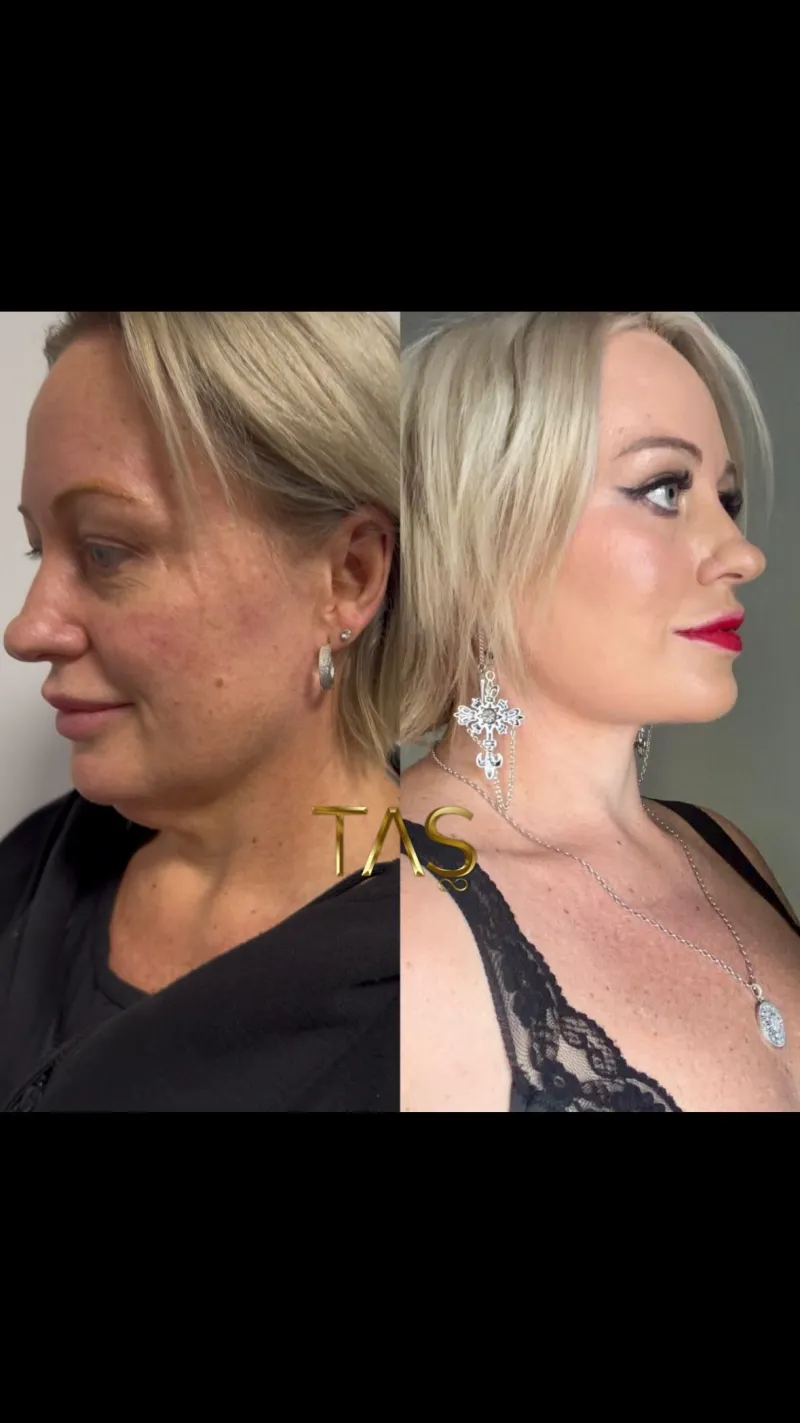 Before and after: Dr. Süleyman Taş