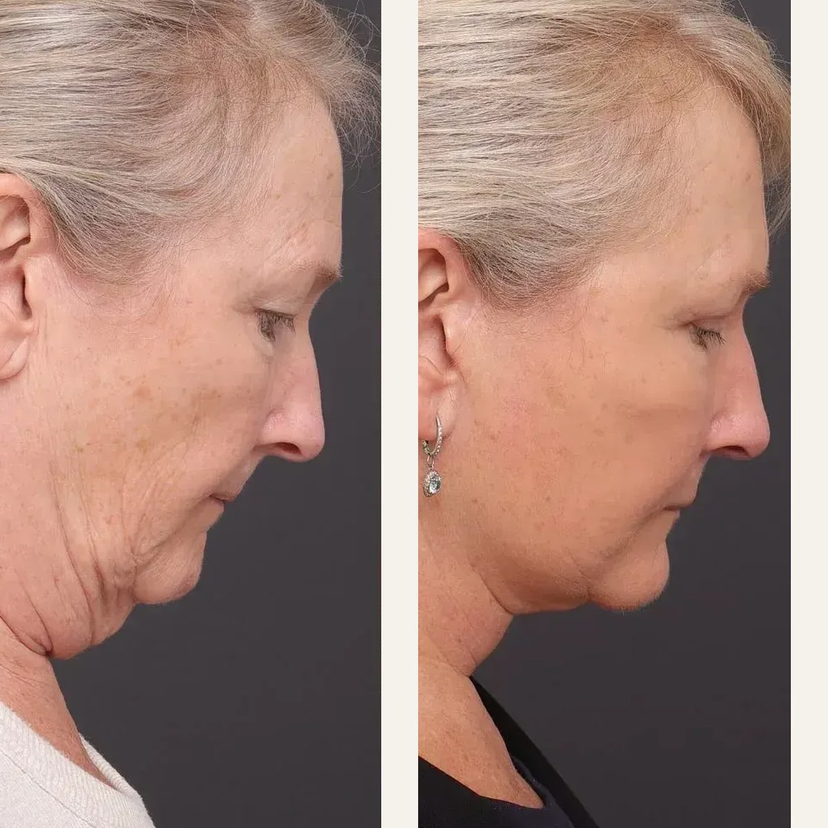 Before and after: Prof. Sydney Ch'ng